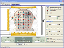 Screenshot of the simulation Simplified MRI